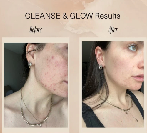 The Glow Ritual Set